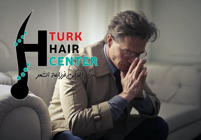 ما هو أفضل مركز لزراعة الشعر في تركيا